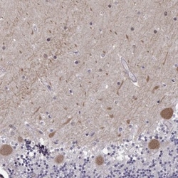 EIF4E1B Antibody, Novus Biologicals:Antibodies:Primary Antibodies